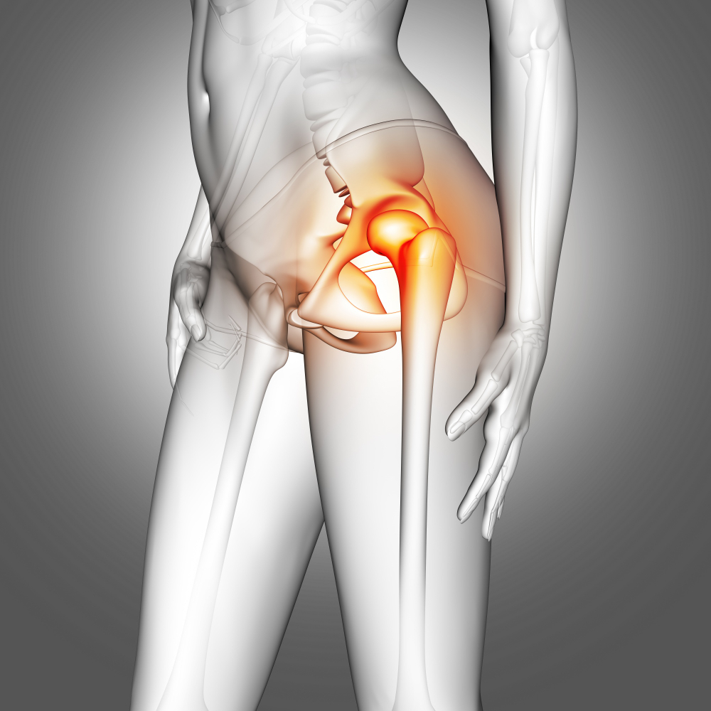 Types of Hip Dislocation