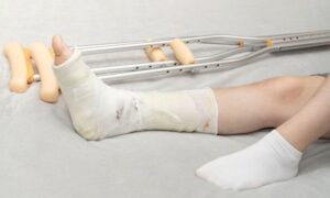 Симптомы перелома кости