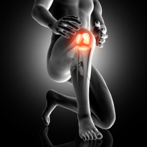 Что вызывает кальцификацию колена?
