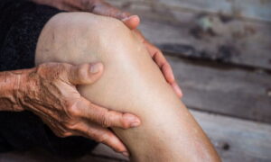 Кальцификация коленного сустава у пожилых людей