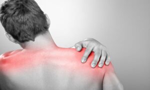 What is Shoulder Impingement?