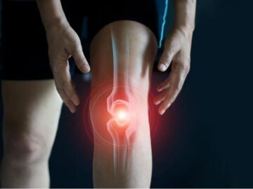 Knee Calcification Surgery