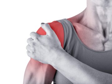 Shoulder Impingement Syndrome