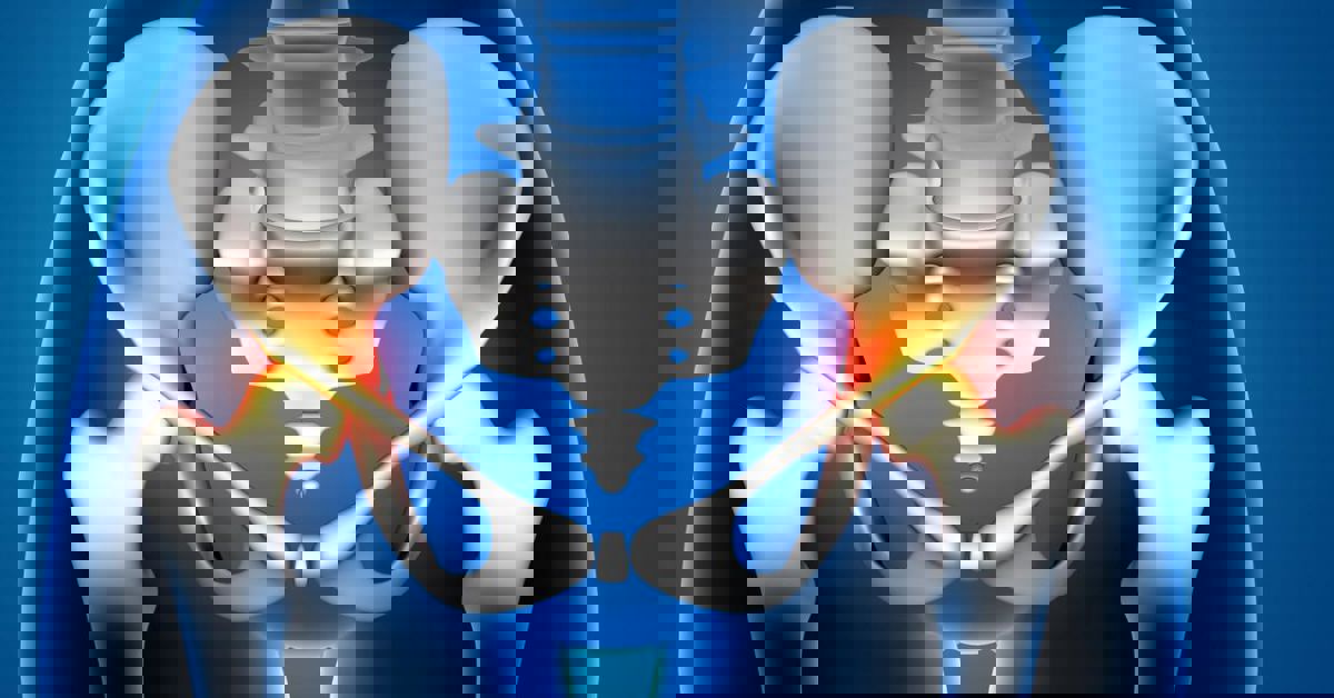 Gençlerde Kalça Çıkığı Gençlerde Kalça Çıkığı