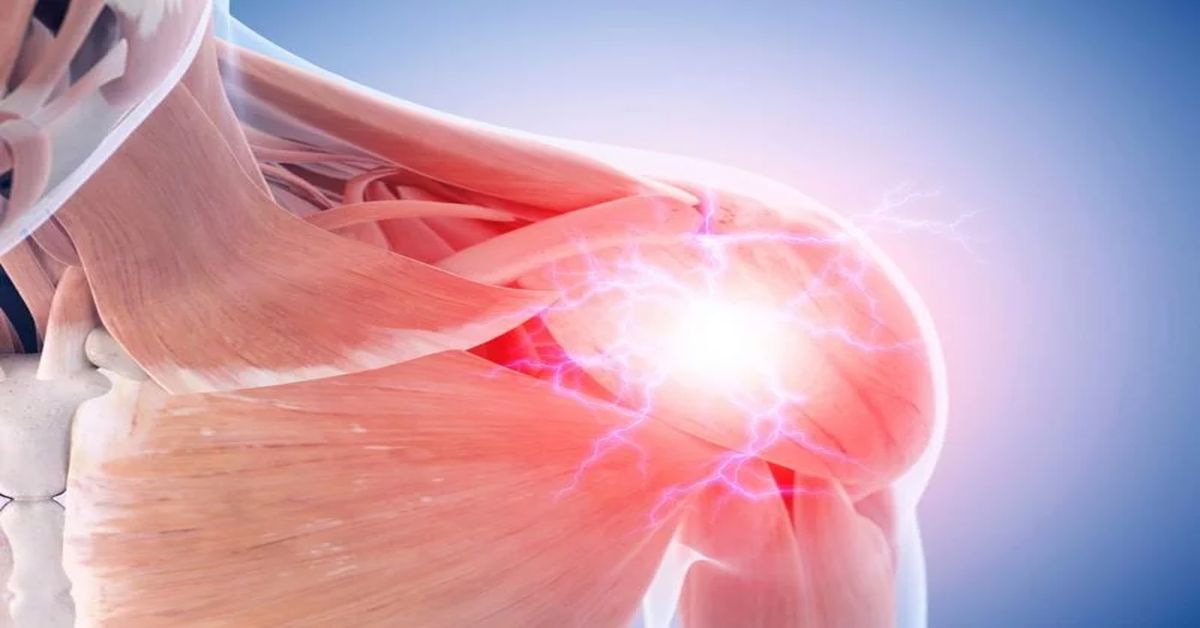 Omuz Labrum Yırtığı