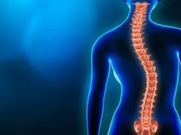 Skolyoz Hastalığı