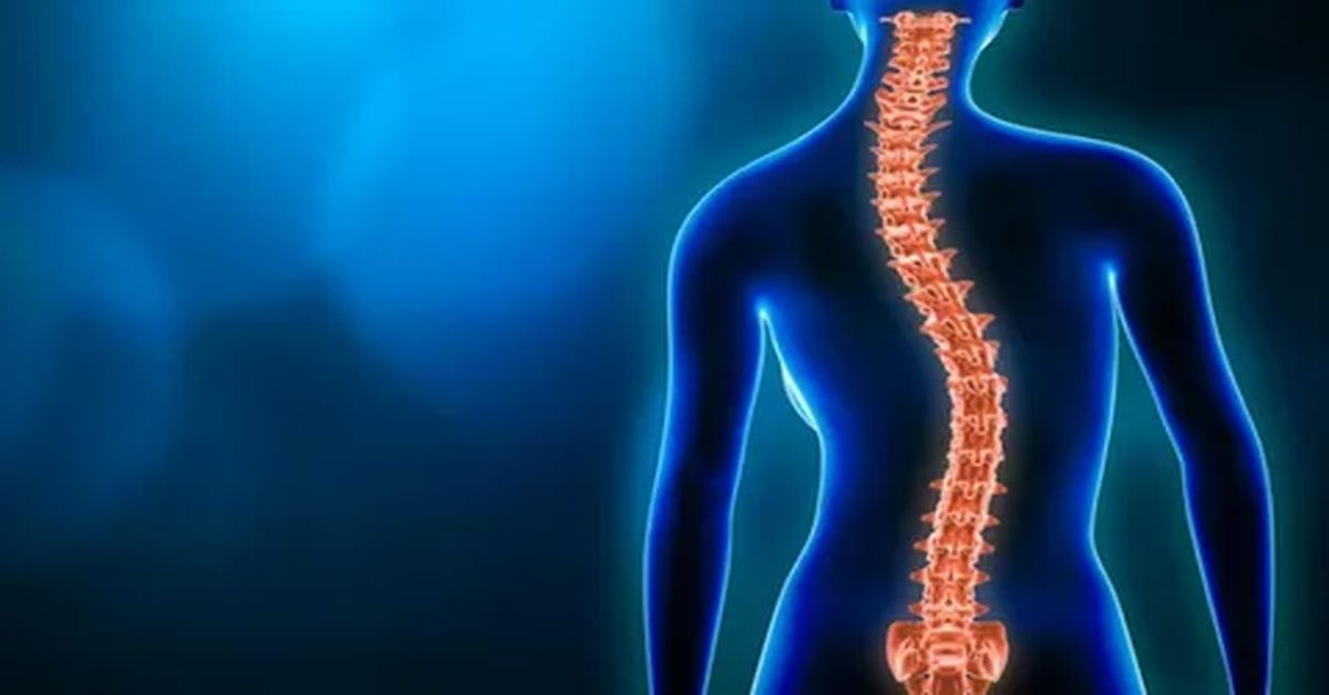 Skolyoz Hastalığı