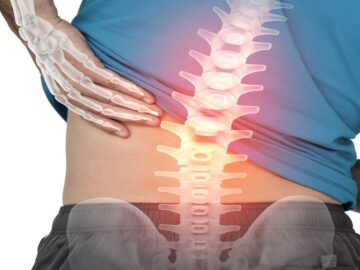 Bel Fıtığı Ameliyatı