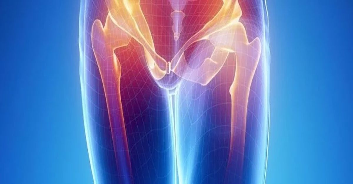 Kalça Kireçlenmesi Neden Olur?