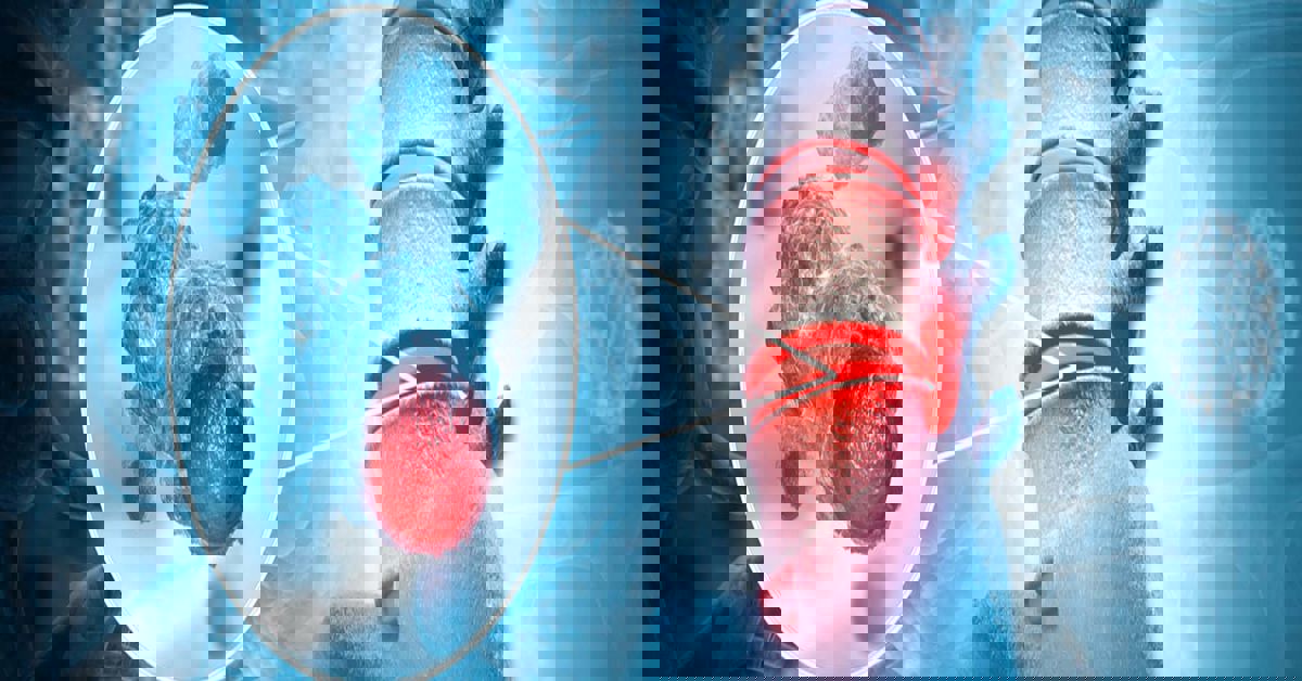 Yumuşak Doku Tümörü