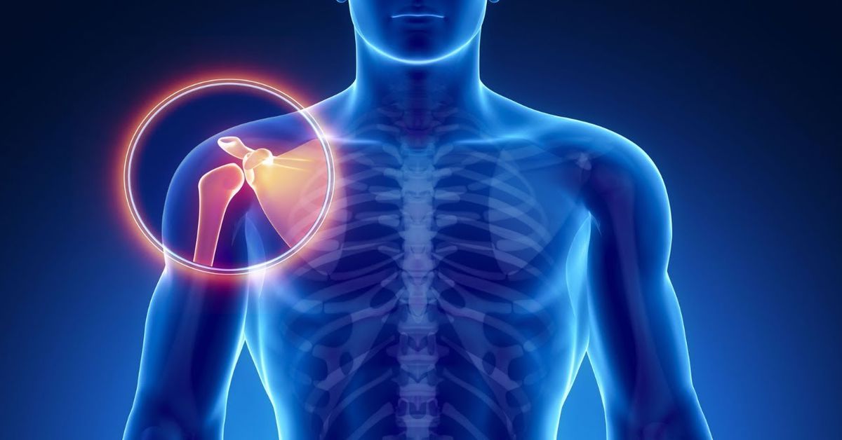 Eklem Çıkığı Eklem Çıkığı