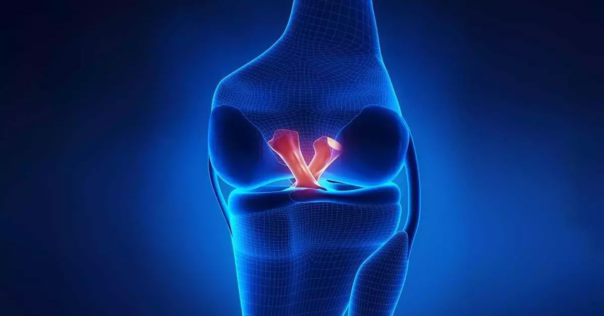 Ön Çapraz Bağ Yırtılması