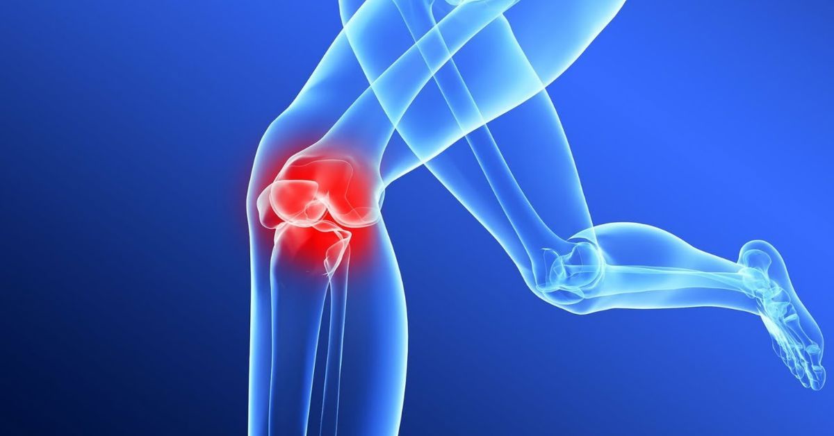 Ön Çapraz Bağ Yırtılması