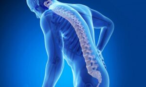 Osteoporosis Disease Symptoms