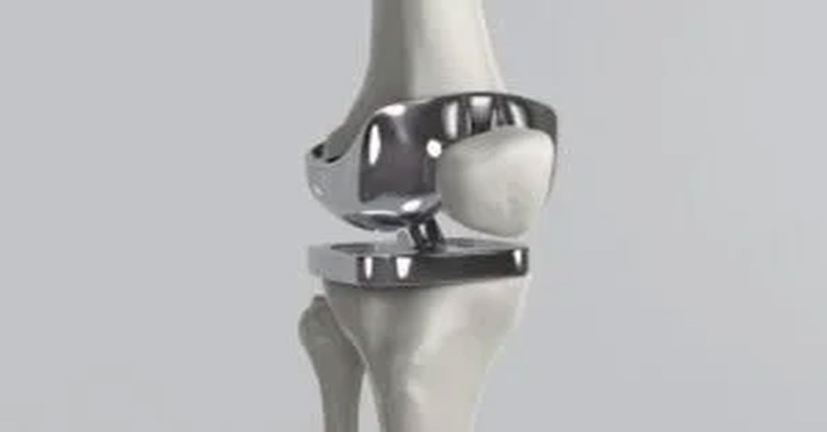 Diz Protezi Tedavisi