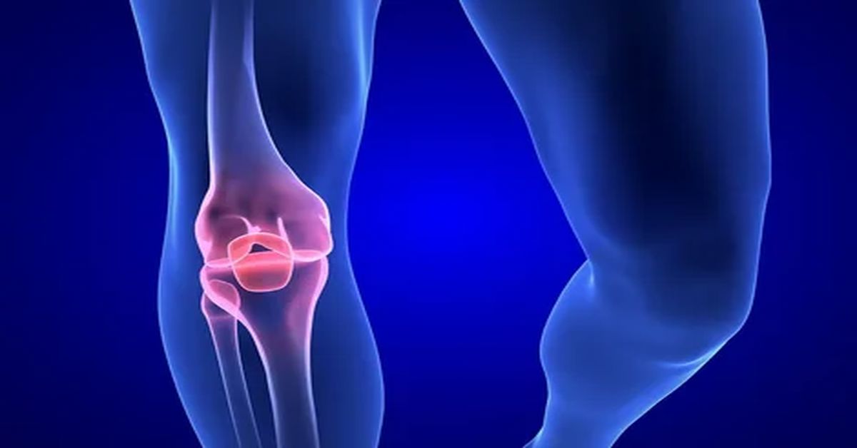 Diz Eklemi Çıkığı