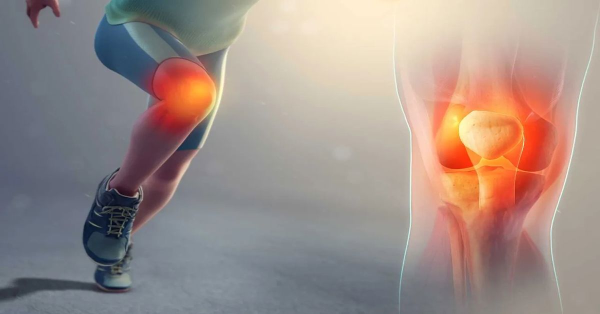 Osteoartrit Ameliyatı Osteoartrit Ameliyatı