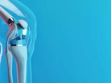 Что такое коленный протез?