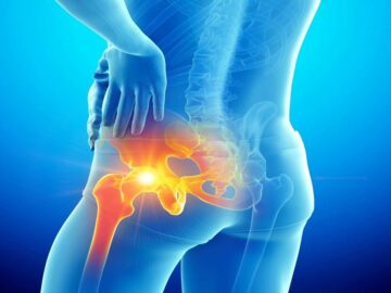 Kalça Kırığı Ameliyatı