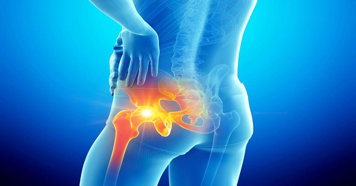 Kalça Kırığı Ameliyatı