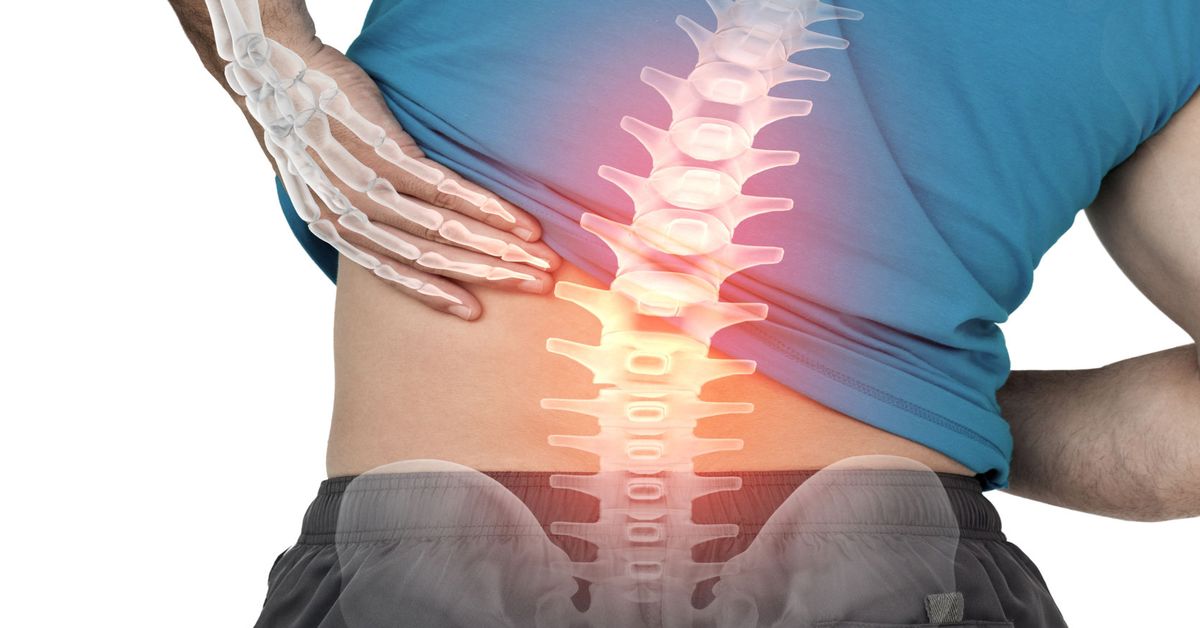 Omurga Fıtığı Nedir? Omurga Fıtığı Nedir?